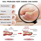 Nail Fungus Treatment Serum Toe Nail Fungus Removal Essence Anti Infection Paronychia Onychomycosis Hand Foot Nail Care Cream