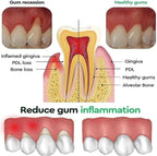 Rapid Repair Gums Gel Effectively Relieve Tooth Allergy Dental Caries Tooth Cleaning Toothpaste Relieve Tooth Damage Serum