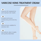 Varicose Veins Repair Ointment Relieve Spider Leg Pain Eliminate Phlebitis Strengthen Capillary Health Phlebitis Removal Cream